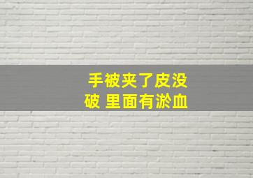 手被夹了皮没破 里面有淤血